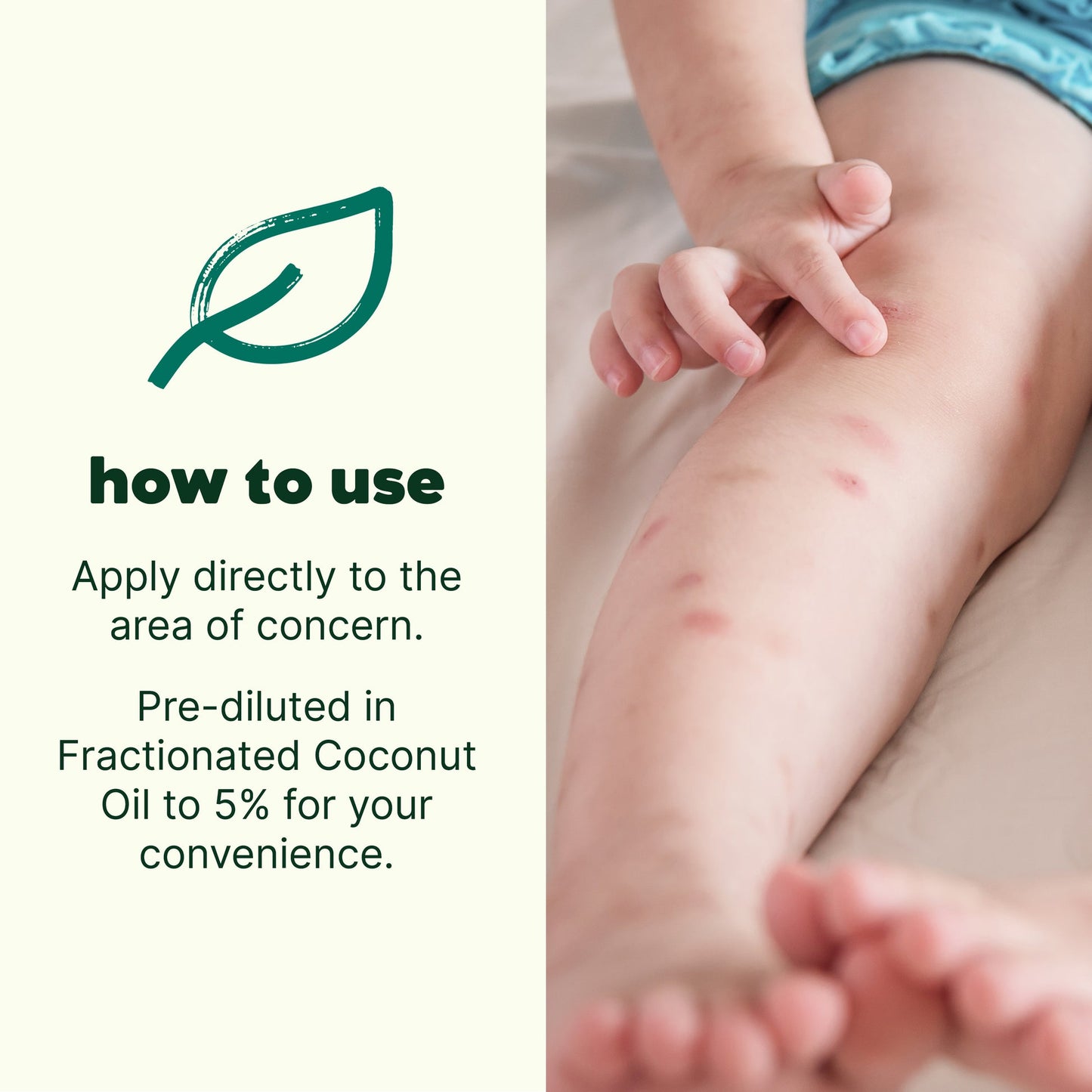 Itch Away Pre Diluted Roller