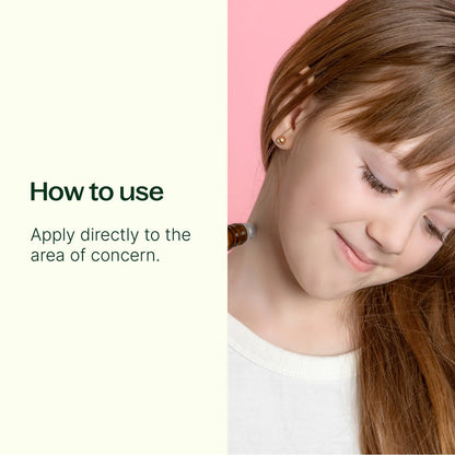 Itch Away Pre Diluted Roller